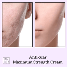 Load image into Gallery viewer, DR.HC Anti-Scar Maximum Strength Cream (10g, 0.35oz.) (Anti-scar, Skin Recovery, Anti-blemish, Anti-inflammatory...)-4
