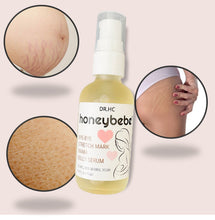 Load image into Gallery viewer, DR.HC Honeybebe&#39; Bye-Bye Stretch Mark Mama Belly Serum (100% Organic, Natural &amp; Vegan) (70ml, 2.4 fl.oz.) (Stretch Mark Prevention &amp; Removal)-2
