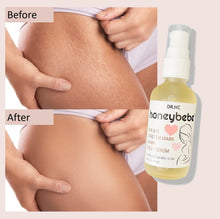 Load image into Gallery viewer, DR.HC Honeybebe&#39; Bye-Bye Stretch Mark Mama Belly Serum (100% Organic, Natural &amp; Vegan) (70ml, 2.4 fl.oz.) (Stretch Mark Prevention &amp; Removal)-3
